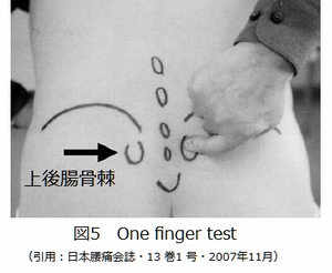 仙腸関節障害 one finger test